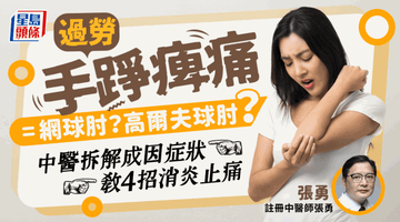 手踭痛易有網球肘高爾夫球肘? 中醫拆解症狀教4招止痛 附食療