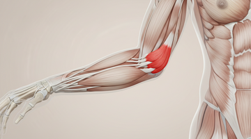 高爾夫球肘手肘內側肱骨內上髁疼痛位置示意圖